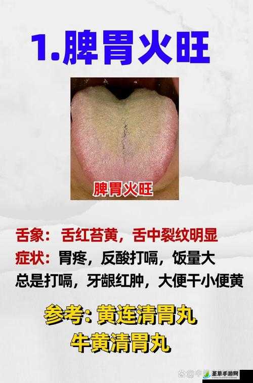 镜流口水白色液体现象正常吗？专家解读：可能是这种疾病的征兆