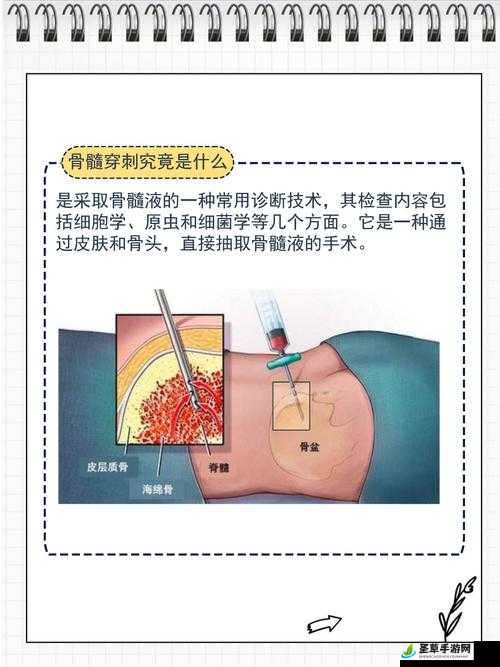 用注射器打水放屁眼里相关网站探秘：深入了解其背后的奥秘